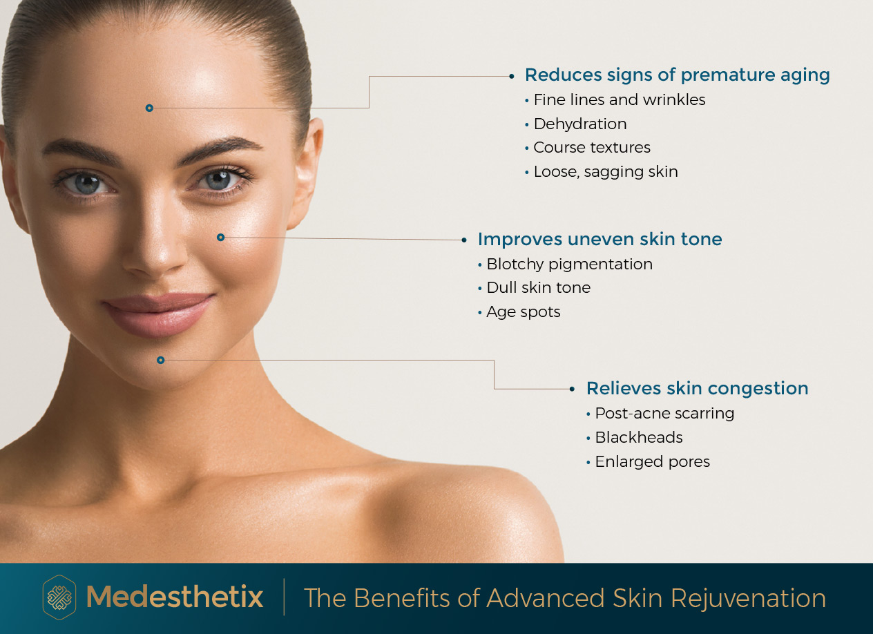 Medesthetix: The Benefits of Advanced Skin Rejuvenation